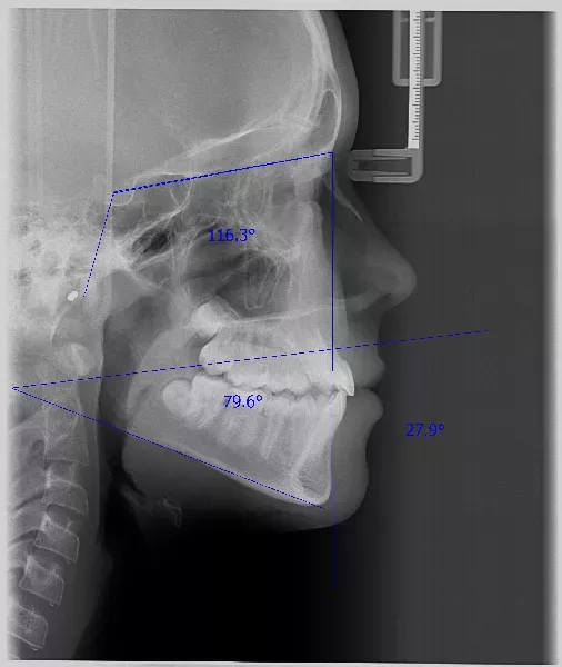 zdjęcie rentgenowskie i tomografia